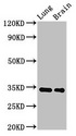 MGLL / Monoacylglycerol Lipase Antibody - Positive Western Blot detected in Rat lung tissue, Mouse brain tissue. All lanes: Mgll antibody at 2.8 µg/ml Secondary Goat polyclonal to rabbit IgG at 1/50000 dilution. Predicted band size: 34, 32 KDa. Observed band size: 34 KDa