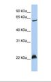 MGRN1 Antibody - 721_B cell lysate. Antibody concentration: 1.0 ug/ml. Gel concentration: 12%.  This image was taken for the unconjugated form of this product. Other forms have not been tested.