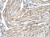 MGST2 Antibody - MGST2 antibody MGST2(microsomal glutathione S-transferase 2) Antibody was used in IHC to stain formalin-fixed, paraffin-embedded human muscle.  This image was taken for the unconjugated form of this product. Other forms have not been tested.