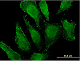 MGST3 Antibody - Immunofluorescence of monoclonal antibody to MGST3 on HeLa cell . [antibody concentration 10 ug/ml]