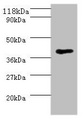 MHT1 Antibody - Western blot All lanes: Homocysteine S-methyltransferase 1 antibody at 2µg/ml + 293T whole cell lysate Secondary Goat polyclonal to rabbit IgG at 1/10000 dilution Predicted band size: 37 kDa Observed band size: 37 kDa
