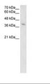MICA Antibody - Jurkat Cell Lysate.  This image was taken for the unconjugated form of this product. Other forms have not been tested.