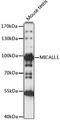 MICALL1 / MICAL-L1 Antibody - Western blot analysis of extracts of Mouse testis, using MICALL1 antibody at 1:1000 dilution. The secondary antibody used was an HRP Goat Anti-Rabbit IgG (H+L) at 1:10000 dilution. Lysates were loaded 25ug per lane and 3% nonfat dry milk in TBST was used for blocking. An ECL Kit was used for detection and the exposure time was 30S.