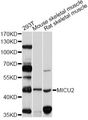 MICU2 / EFHA1 Antibody - Western blot analysis of extracts of various cell lines, using MICU2 antibody at 1:1000 dilution. The secondary antibody used was an HRP Goat Anti-Rabbit IgG (H+L) at 1:10000 dilution. Lysates were loaded 25ug per lane and 3% nonfat dry milk in TBST was used for blocking. An ECL Kit was used for detection and the exposure time was 10s.
