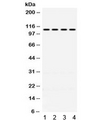 Mineralocorticoid Receptor Antibody