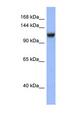 Mineralocorticoid Receptor Antibody - NR3C2 antibody Western blot of HT1080 cell lysate. This image was taken for the unconjugated form of this product. Other forms have not been tested.