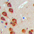 MINK1 / MINK Antibody - Immunohistochemical analysis of MEKKK6 staining in human brain formalin fixed paraffin embedded tissue section. The section was pre-treated using heat mediated antigen retrieval with sodium citrate buffer (pH 6.0). The section was then incubated with the antibody at room temperature and detected using an HRP conjugated compact polymer system. DAB was used as the chromogen. The section was then counterstained with hematoxylin and mounted with DPX.