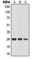 MIP / AQP0 / Aquaporin 0 Antibody - Western blot analysis of Aquaporin 0 expression in HeLa (A); SP2/0 (B); PC12 (C) whole cell lysates.