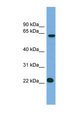 MIS18A / B28 Antibody - MIS18A / C21orf45 antibody Western blot of NCI-H226 cell lysate. This image was taken for the unconjugated form of this product. Other forms have not been tested.