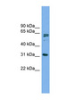 MITD1 Antibody - MITD1 antibody Western blot of MCF7 cell lysate. This image was taken for the unconjugated form of this product. Other forms have not been tested.
