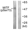 MITF Antibody - Western blot analysis of lysates from COS7 cells, using MITF (Phospho-Ser180/73) Antibody. The lane on the right is blocked with the phospho peptide.
