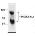 Mitofusin 2 / MFN2 Antibody - Western blot of Mitofusin 2 / MFN2 antibody.