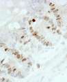 MKI67 / Ki67 Antibody - Detection of Mouse Ki-67 by Immunohistochemistry. Sample: FFPE section of mouse intestine. Antibody: Affinity purified rabbit anti-mouse Ki-67 used at a dilution of 1:250. Epitope Retrieval Buffer-High pH (IHC-101J) was substituted for Epitope Retrieval Buffer-Reduced pH.