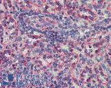 MKNK2 / MNK2 Antibody - Anti-MKNK2 / MNK2 antibody IHC of human spleen. Immunohistochemistry of formalin-fixed, paraffin-embedded tissue after heat-induced antigen retrieval. Antibody concentration 5 ug/ml.  This image was taken for the unconjugated form of this product. Other forms have not been tested.