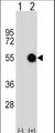 MKRN2 Antibody - Western blot of MKRN2 (arrow) using rabbit polyclonal MKRN2 Antibody. 293 cell lysates (2 ug/lane) either nontransfected (Lane 1) or transiently transfected (Lane 2) with the MKRN2 gene.