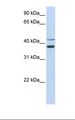 MKRN2 Antibody - Hela cell lysate. Antibody concentration: 1.0 ug/ml. Gel concentration: 12%.  This image was taken for the unconjugated form of this product. Other forms have not been tested.