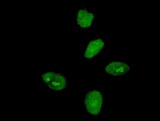 MKRN3 Antibody - Immunofluorescence of monoclonal antibody to MKRN3 on HeLa cell . [antibody concentration 10 ug/ml]
