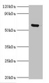 MKS1 Antibody - Western blot All lanes: MKS1 antibody at 6µg/ml + Hela whole cell lysate Secondary Goat polyclonal to rabbit IgG at 1/10000 dilution Predicted band size: 65, 60, 64 kDa Observed band size: 65 kDa