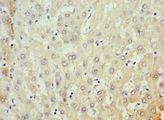 MKS1 Antibody - Immunohistochemistry of paraffin-embedded human liver tissue using antibody 1:100 dilution.