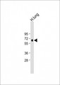 MKS1 Antibody - Anti-MKS1 Antibody (N-Term) at 1:2000 dilution + Human lung lysate Lysates/proteins at 20 µg per lane. Secondary Goat Anti-Rabbit IgG, (H+L), Peroxidase conjugated at 1/10000 dilution. Predicted band size: 65 kDa Blocking/Dilution buffer: 5% NFDM/TBST.