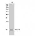 MLANA / Melan-A Antibody - Western blot of Melan-A antibody