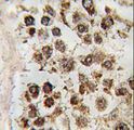 MLLT10 Antibody - Formalin-fixed and paraffin-embedded human testis tissue reacted with MLLT10 antibody , which was peroxidase-conjugated to the secondary antibody, followed by DAB staining. This data demonstrates the use of this antibody for immunohistochemistry; clinical relevance has not been evaluated.