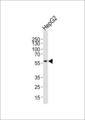 MLLT3 / AF9 Antibody - Western blot of lysate from HepG2 cell line, using MLLT3 C-term Antibody. Antibody was diluted at 1:1000 at each lane. A goat anti-rabbit IgG H&L (HRP) at 1:5000 dilution was used as the secondary antibody. Lysate at 35ug per lane.