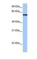 MLLT3 / AF9 Antibody - HepG2 cell lysate. Antibody concentration: 1.0 ug/ml. Gel concentration: 12%.  This image was taken for the unconjugated form of this product. Other forms have not been tested.