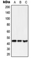 MLNR/GPR38/Motilin Receptor Antibody - Western blot analysis of GPR38 expression in HEK293T (A); SP2/0 (B); NIH3T3 (C) whole cell lysates.