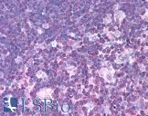 MLXIPL / CHREBP Antibody - Anti-MLXIPL / CHREBP antibody IHC of human thymus. Immunohistochemistry of formalin-fixed, paraffin-embedded tissue after heat-induced antigen retrieval. Antibody concentration 5 ug/ml.  This image was taken for the unconjugated form of this product. Other forms have not been tested.