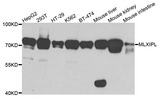 MLXIPL / CHREBP Antibody - Western blot analysis of extracts of various cells.