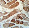MMAA Antibody - MMAA Antibody IHC of formalin-fixed and paraffin-embedded human skeletal muscle tissue followed by peroxidase-conjugated secondary antibody and DAB staining.