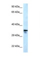 MMACHC Antibody - MMACHC antibody Western blot of U937 Cell lysate. Antibody concentration 1 ug/ml.  This image was taken for the unconjugated form of this product. Other forms have not been tested.