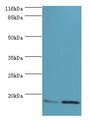 MMGT1 Antibody - Western blot. All lanes: MMGT1 antibody at 12 ug/ml. Lane 1: HeLa whole cell lysate Lane 2: 293T whole cell lysate. Secondary antibody: goat polyclonal to rabbit at 1:10000 dilution. Predicted band size: 15 kDa. Observed band size: 15 kDa.  This image was taken for the unconjugated form of this product. Other forms have not been tested.