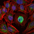 MMP1 Antibody - Immunofluorescence of HeLa cells using MMP1 mouse monoclonal antibody (green). Blue: DRAQ5 fluorescent DNA dye. Red: Actin filaments have been labeled with Alexa Fluor-555 phalloidin.