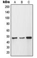MMP12 Antibody - Western blot analysis of MMP12 expression in A549 (A); HEK293 (B); HeLa (C) whole cell lysates.