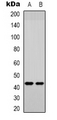 MMP12 Antibody - Western blot analysis of MMP12 expression in A549 (A); NIH3T3 (B) whole cell lysates.