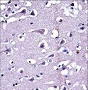 MMP16 Antibody - MMP16 Antibody immunohistochemistry of formalin-fixed and paraffin-embedded human brain tissue followed by peroxidase-conjugated secondary antibody and DAB staining.
