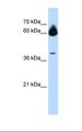 MMP23 Antibody - Jurkat cell lysate. Antibody concentration: 1.0 ug/ml. Gel concentration: 12%.  This image was taken for the unconjugated form of this product. Other forms have not been tested.