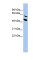 MMP24 Antibody - MMP24 antibody Western blot of HepG2 cell lysate. This image was taken for the unconjugated form of this product. Other forms have not been tested.