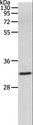 MMP26 Antibody - Western blot analysis of 293T cell, using MMP26 Polyclonal Antibody at dilution of 1:500.
