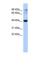 MMP3 Antibody - MMP3 antibody Western blot of Jurkat lysate. This image was taken for the unconjugated form of this product. Other forms have not been tested.
