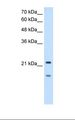 MMP7 / Matrilysin Antibody - HepG2 cell lysate. Antibody concentration: 2.5 ug/ml. Gel concentration: 12%.  This image was taken for the unconjugated form of this product. Other forms have not been tested.
