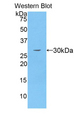MMRN1 Antibody - Western blot of recombinant MMRN1.  This image was taken for the unconjugated form of this product. Other forms have not been tested.
