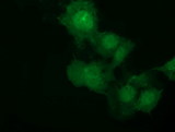 MMS21 / NSMCE2 Antibody - Anti-NSMCE2 mouse monoclonal antibody  immunofluorescent staining of COS7 cells transiently transfected by pCMV6-ENTRY NSMCE2.