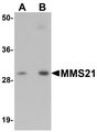 MMS21 / NSMCE2 Antibody - Western blot analysis of MMS21 in 293 cell lysate with MMS21 antibody at (A) 0.5 and (B) 1 ug/ml.