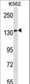 MN1 Antibody - MN1 Antibody western blot of K562 cell line lysates (35 ug/lane). The MN1 antibody detected the MN1 protein (arrow).