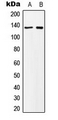 MN1 Antibody - Western blot analysis of MN1 expression in K562 (A); NIH3T3 (B) whole cell lysates.