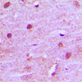 MNAT1 Antibody - Immunohistochemical analysis of MNAT1 staining in human brain formalin fixed paraffin embedded tissue section. The section was pre-treated using heat mediated antigen retrieval with sodium citrate buffer (pH 6.0). The section was then incubated with the antibody at room temperature and detected using an HRP conjugated compact polymer system. DAB was used as the chromogen. The section was then counterstained with hematoxylin and mounted with DPX.
