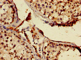 MNAT1 Antibody - Immunohistochemistry image of paraffin-embedded human testis tissue at a dilution of 1:100